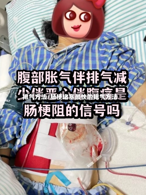 排气方法/肠梗堵塞最快的排气方法